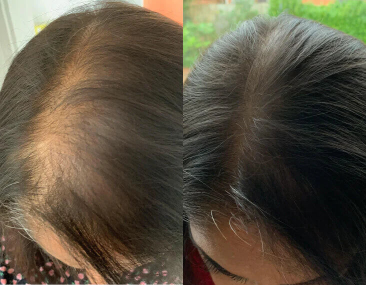 Left Side Image